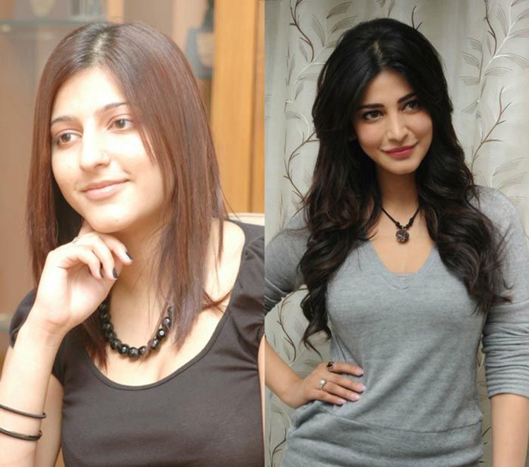 Shruti Haasan Nose Shape Change