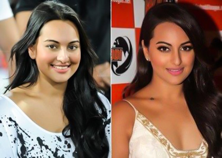 Sonakshi Sinha Nose Shape Change