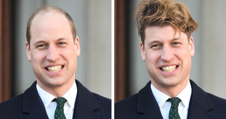 Bald Celebrities 3