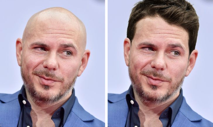 Bald Celebrities 5