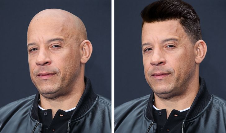 Bald Celebrities