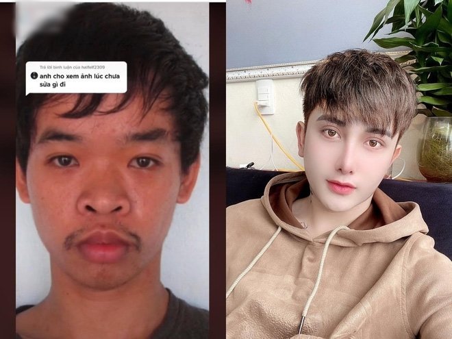 Failling To Get A Job, Man Spends $17,000 On Plastic Surgery To Change ...