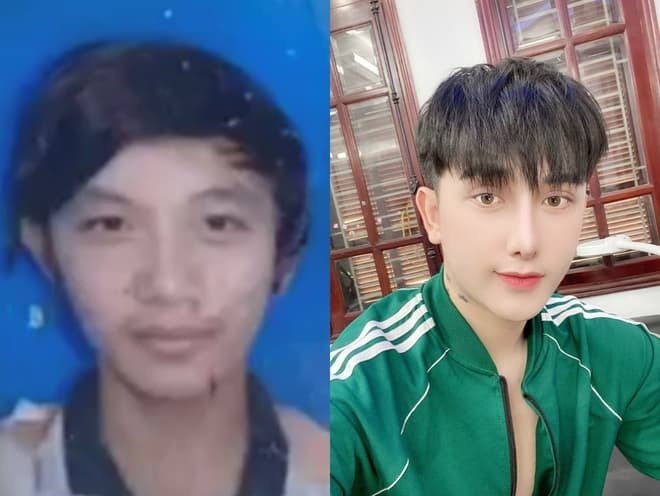 Cosmetic Surgery3