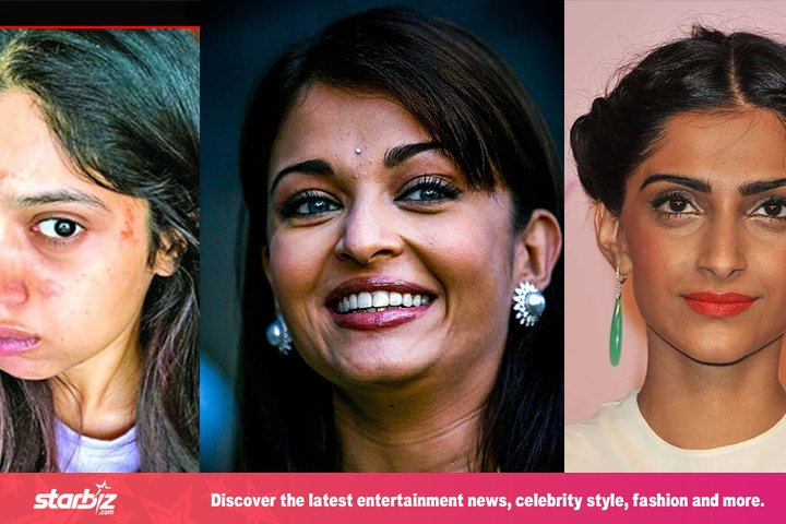 5 Bollywood Actresses With Bad Skin | Truth Beneath Makeup Layers -  